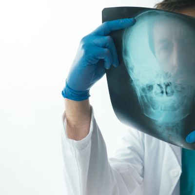 Roseville catastrophic injury attorney reviewing a client's TBI and spinal cord injury claim